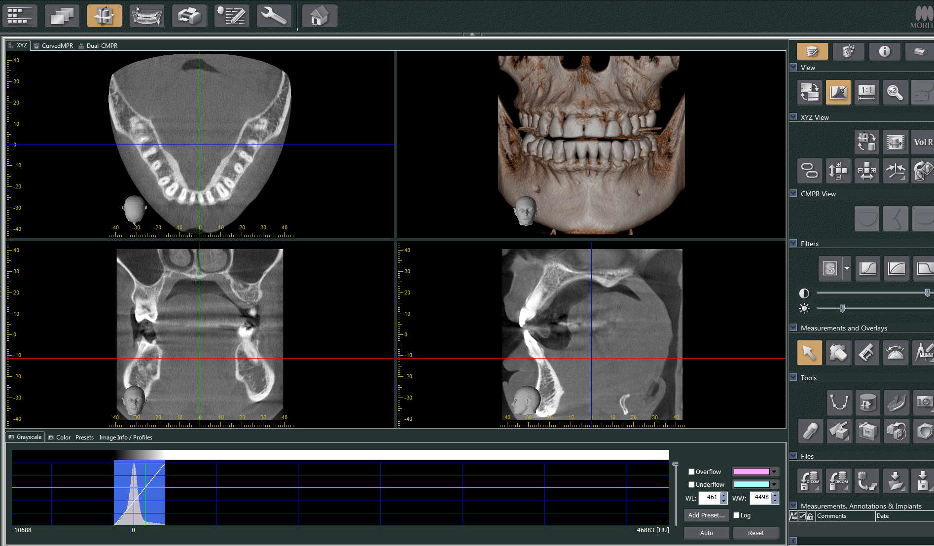 tomografia odontologica